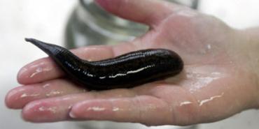 К чему снятся пиявки