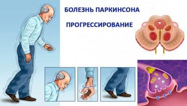 Шотландка обладает невероятным даром чувствовать запах болезни Паркинсона